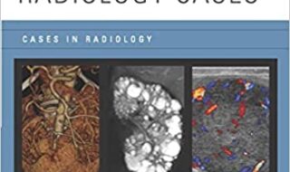 دانلود کتاب Genitourinary Radiology Cases in Radiology دانلود ایبوک موارد رادیولوژی ادراری تناسلی در رادیولوژی