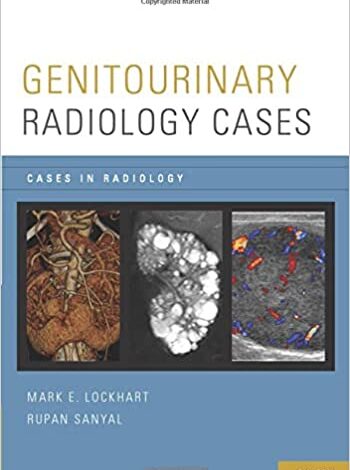 دانلود کتاب Genitourinary Radiology Cases in Radiology دانلود ایبوک موارد رادیولوژی ادراری تناسلی در رادیولوژی